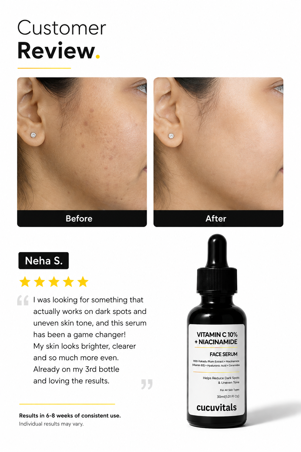 Vitamin C 10% + Niacinamide Face Serum
