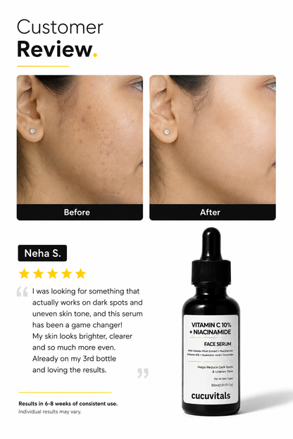 Vitamin C 10% + Niacinamide Face Serum